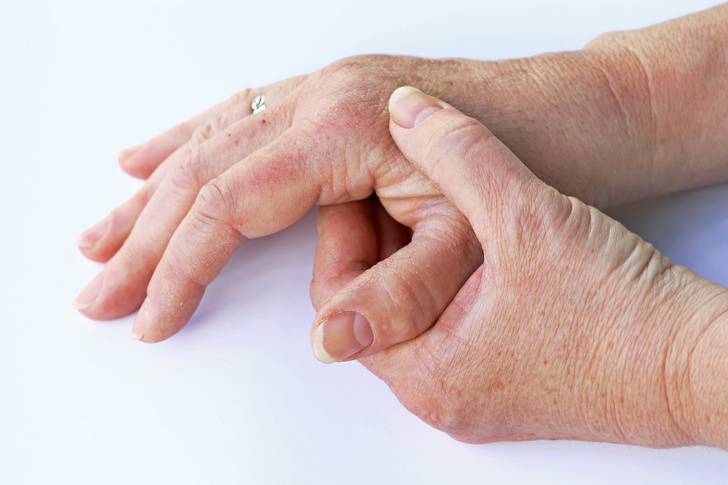 تشخیص بیماری مرگبار از روی دست‌ها