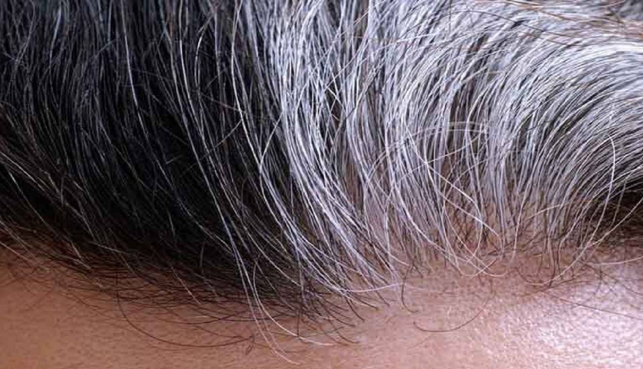 درمان سفیدی زودرس مو با مصرف این ویتامین