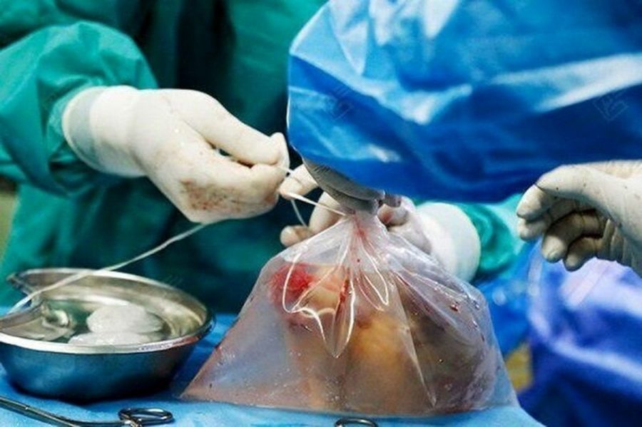 سی و هفتمین اهدای عضو سال جاری در یزد رقم خورد