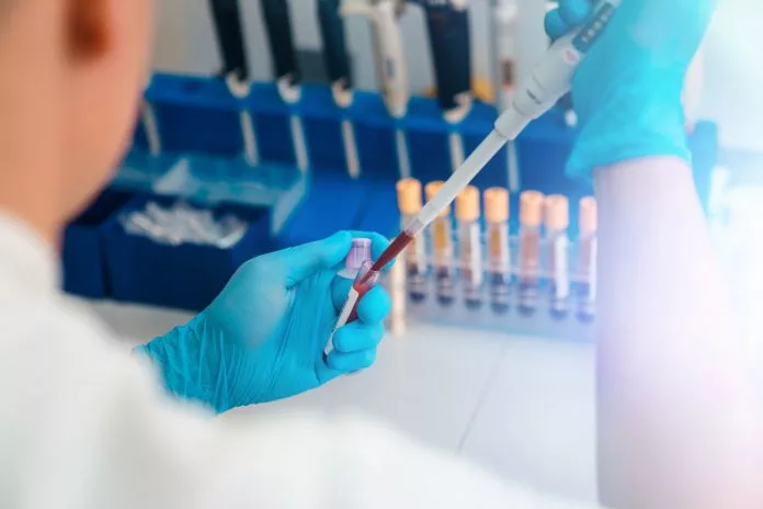 سازمان غذا و داروی آمریکا اولین آزمایش خون برای ده‌ها سرطان ارثی را تأیید کرد