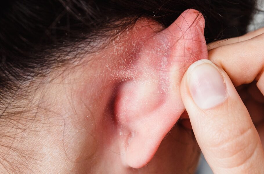 مطالعه جدید: پوست پشت گوش، بین انگشتان پا و ناف می‌تواند میزبان میکروب‌های ناسالم باشد