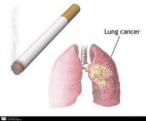  60 درصد قربانیان سرطان ریه سيگاری اند/ مصرف دخانيات خطرسرطان سينه را افزايش مي دهد